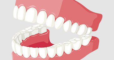 牙博士牙齿美白物超所值