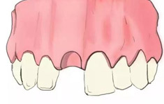 不同的牙齿情况